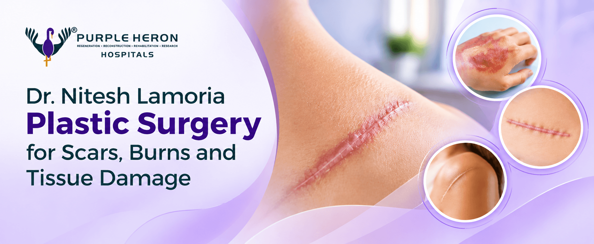 Dr. Nitesh Lamoria Plastic Surgery for Scars, Burns and Tissue Damage
